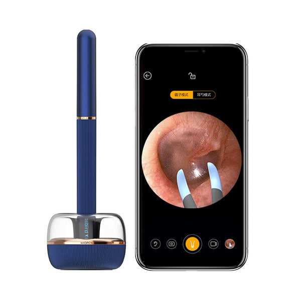 BeBird Note 3 Pro Robotic Smart Visual Ear Cleaning Endoscope