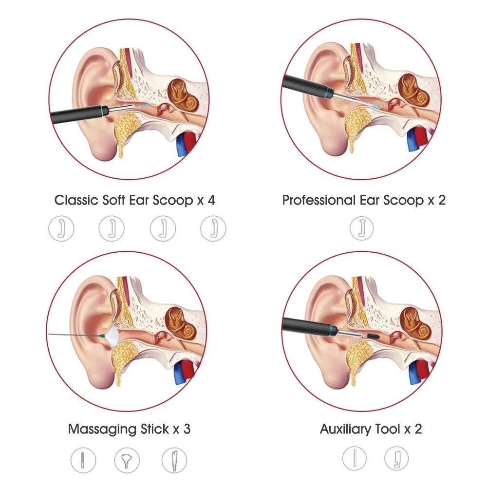 Bebird M9 Pro Smart Visual Ear Stick Scoop Curette 3MP Camera