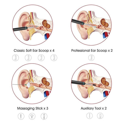 Bebird M9 Pro Smart Visual Ear Stick Scoop Curette 3MP Camera